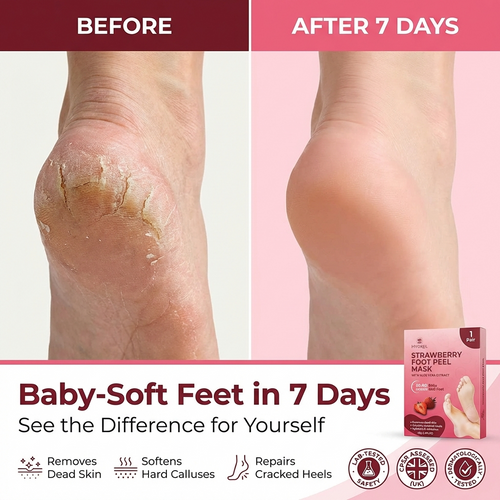 Hydrel Strawberry Foot Peel Mask – Exfoliating Foot Mask with Aloe Vera